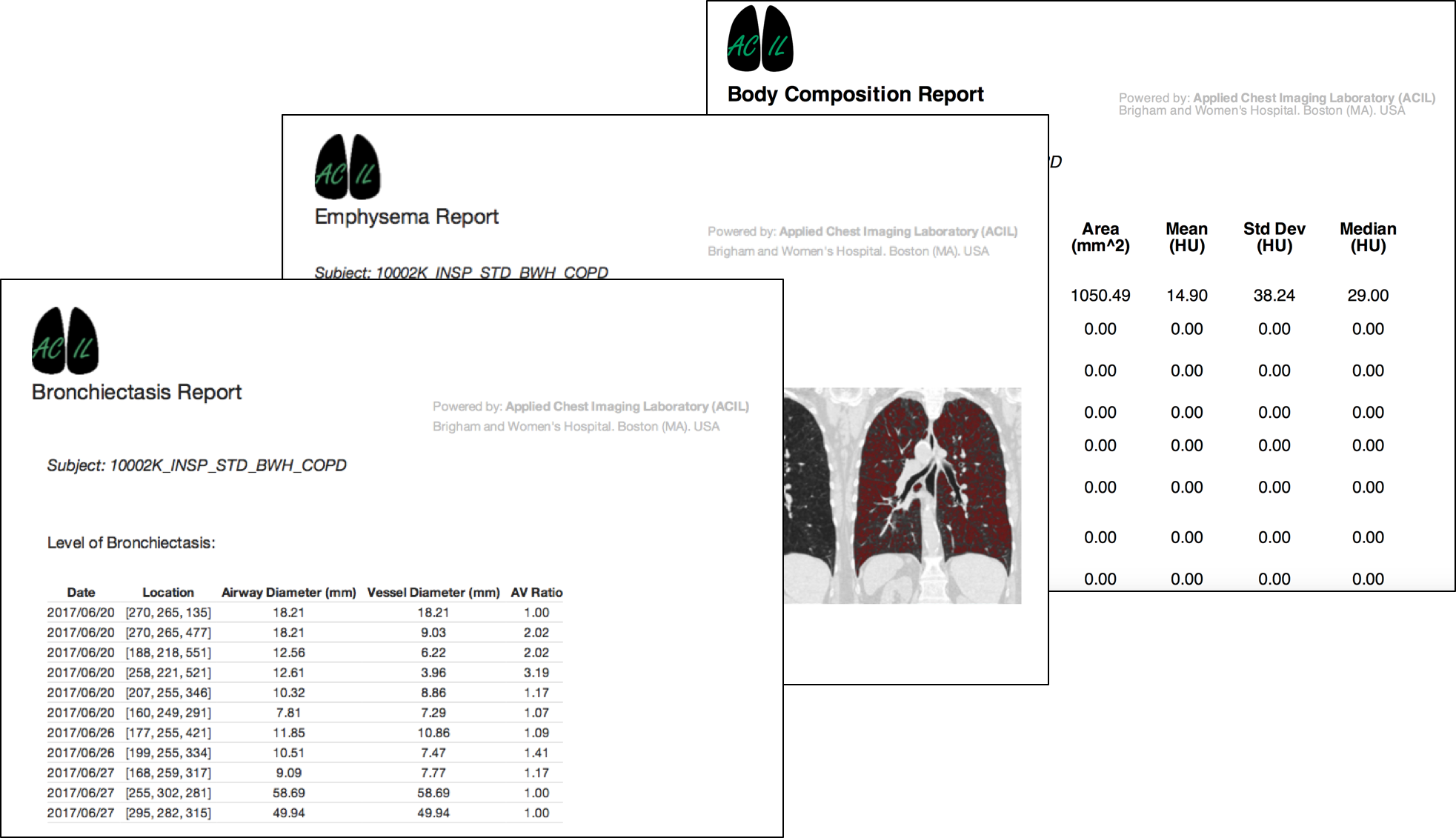 Report Example 1