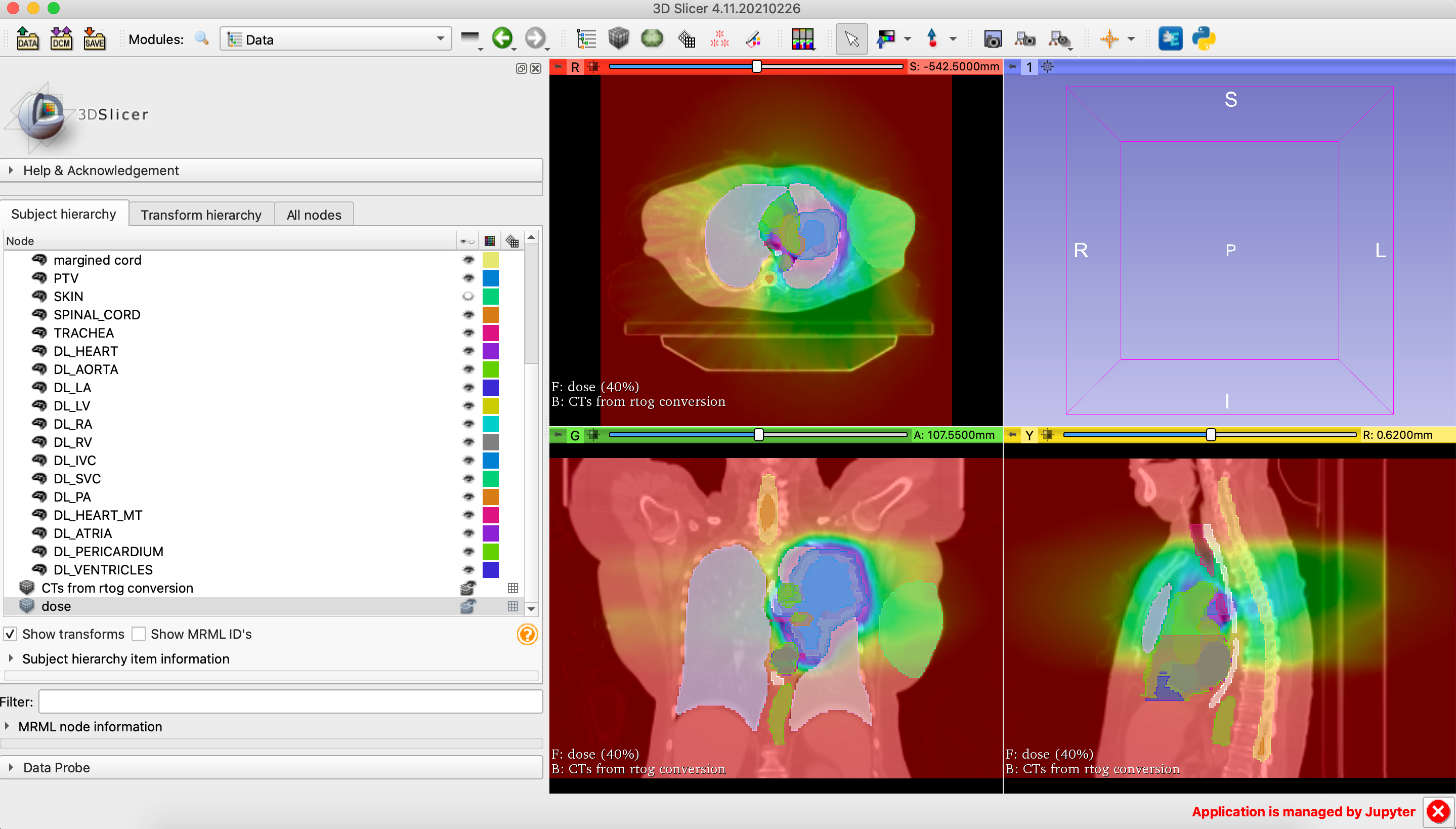 planC with dose in Slicer